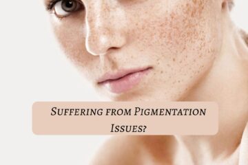 suffering-from-pigmentation-issues?