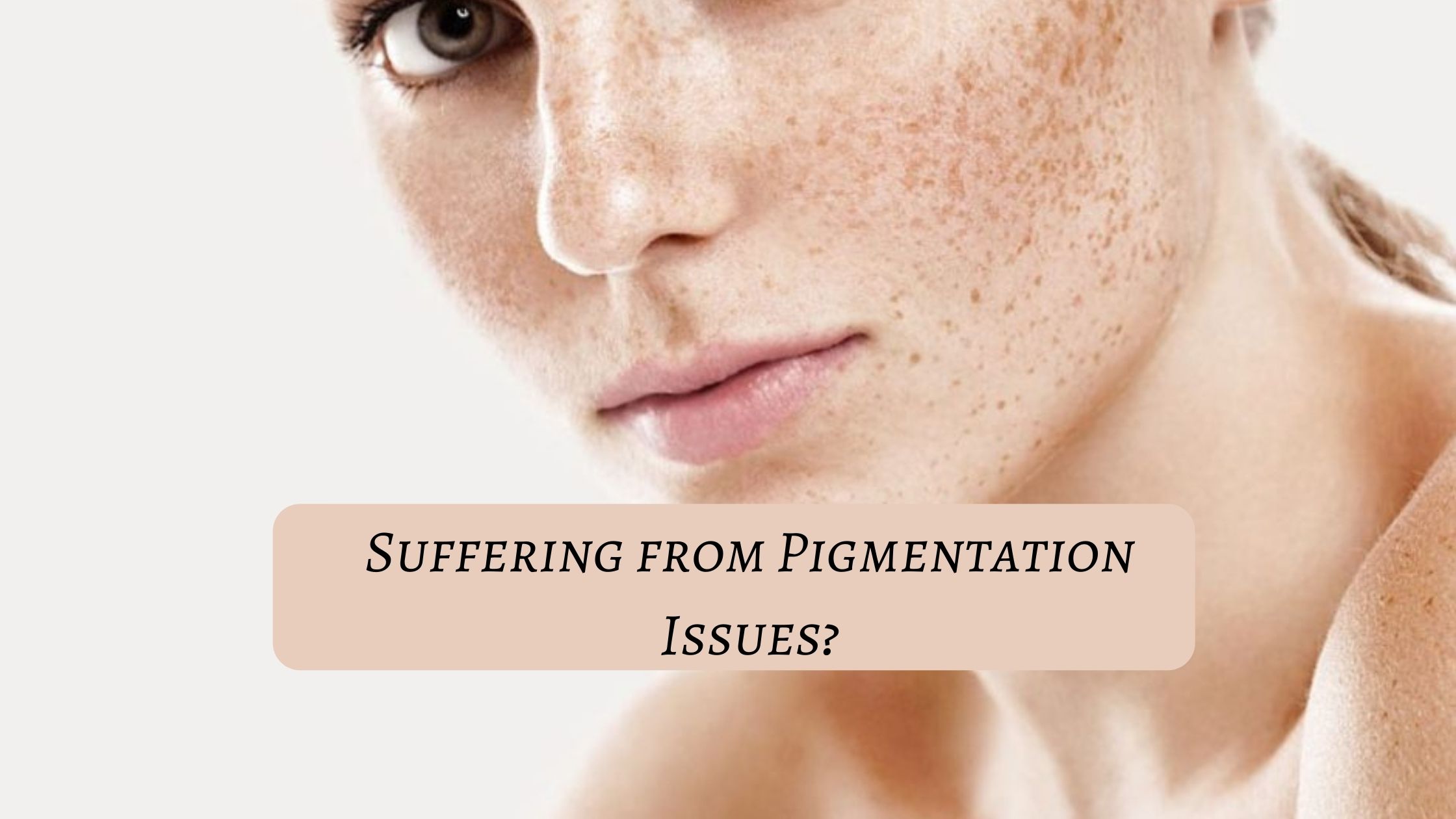 suffering-from-pigmentation-issues?
