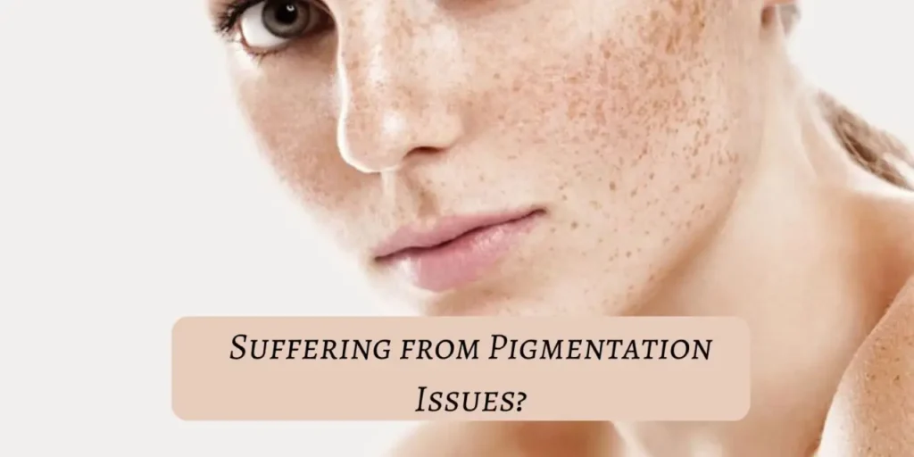 Are you suffering from pigmentation issues? Read on for a solution!